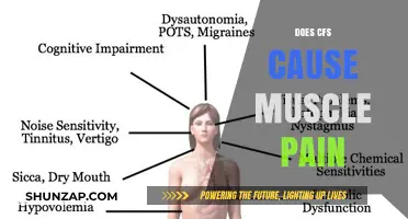Chronic Fatigue Syndrome: Understanding Muscle Pain Connection