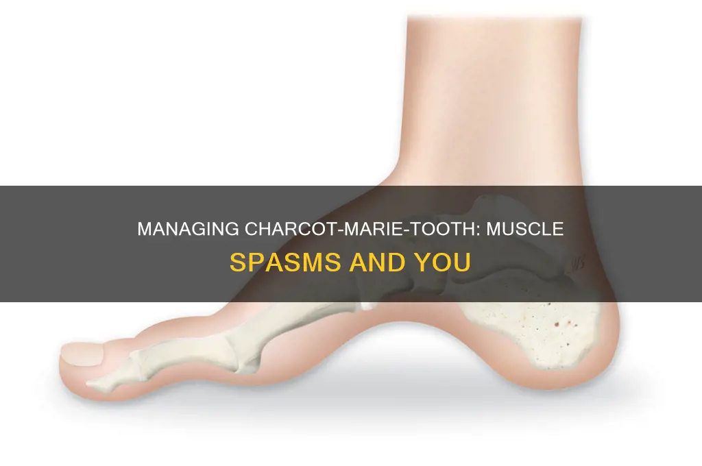 does charcot marie tooth disease cause muscle spasms