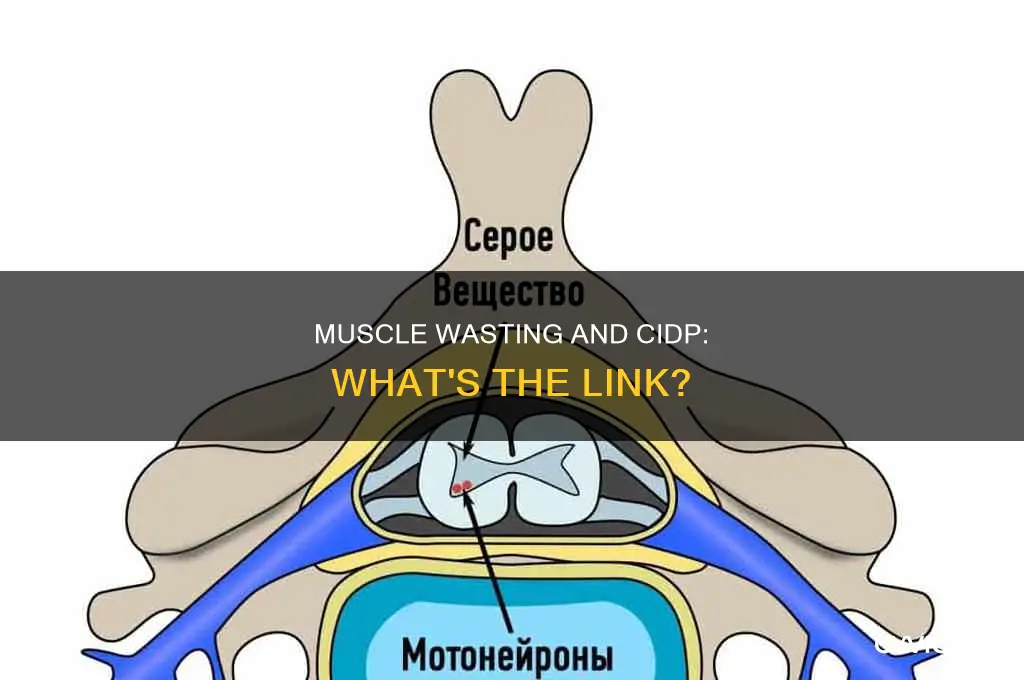 does cidp cause muscle wasting