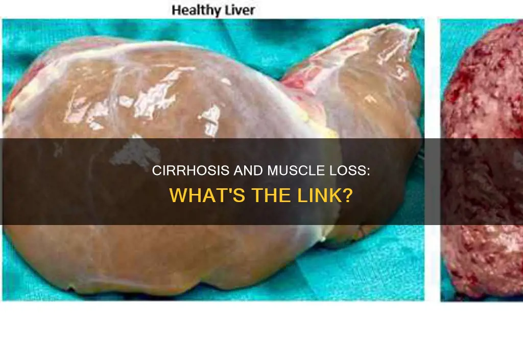does cirrhois cause muscle loss