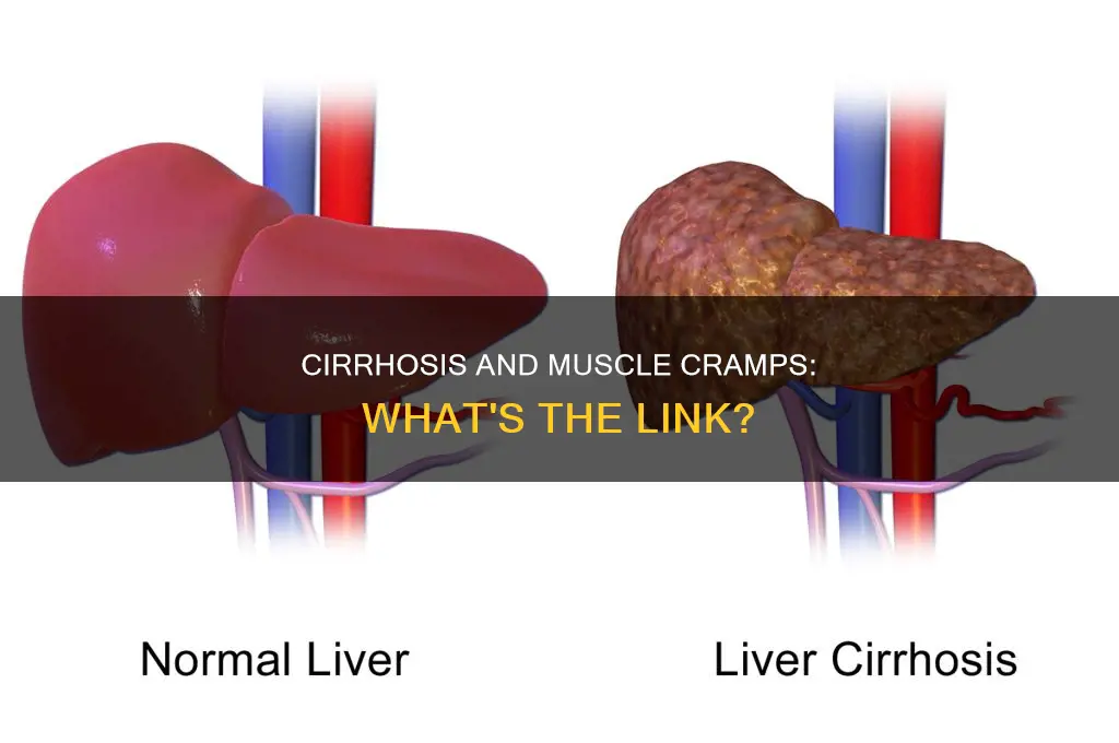 does cirrhosis cause muscle cramps