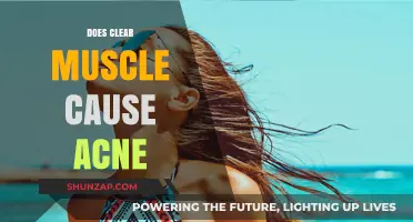 Clear Muscle and Acne: Is There a Link?