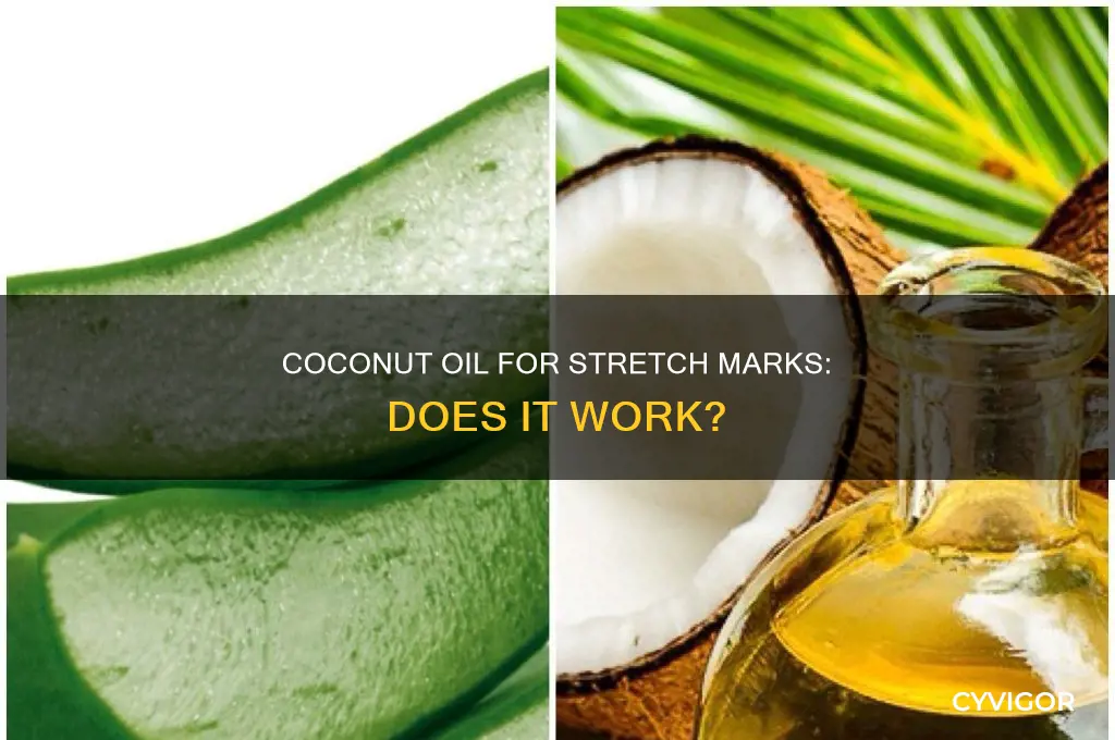 coconut-oil-for-stretch-marks-does-it-work-cyvigor
