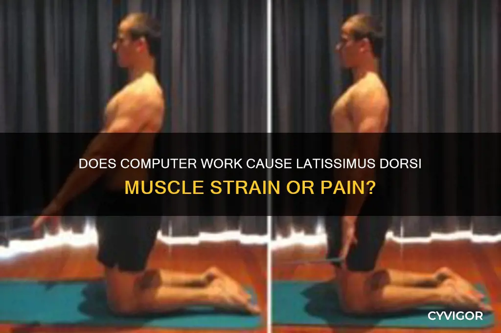 does computer work causelatissimus dorsi muscle