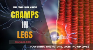 Muscle Cramps: Covid's Under-Discussed Leg Legacy