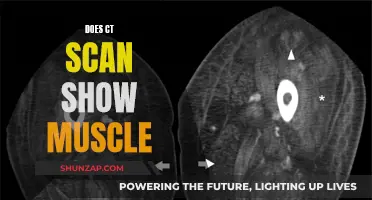 How CT Scans Visualize Our Muscles and More