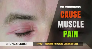 Dermatomyositis: Understanding the Link Between the Disease and Muscle Pain