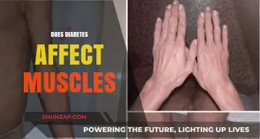 Unveiling the Impact of Diabetes on Muscle Health and Function