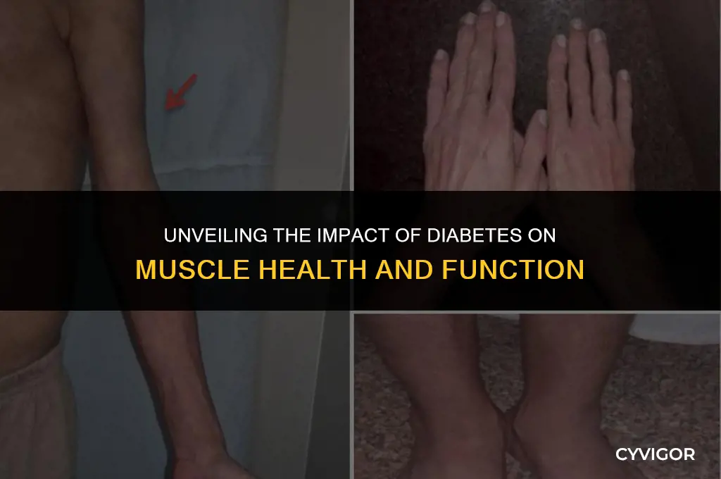 does diabetes affect muscles