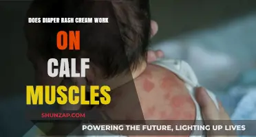 Can Diaper Rash Cream Soothe Sore Calf Muscles? Exploring the Myth