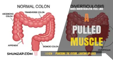 Diverticulitis vs. Pulled Muscle: Unraveling the Pain Mystery