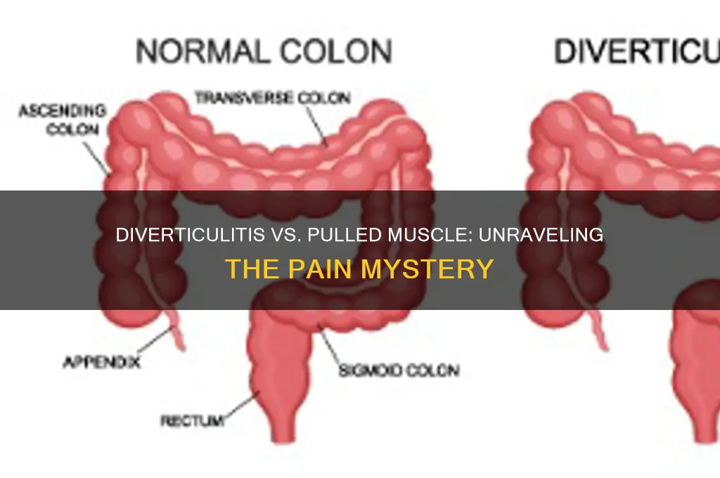 does diverticulitis feel like a pulled muscle