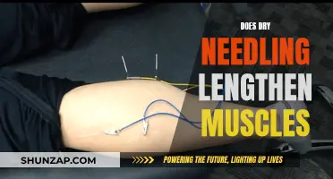 Dry Needling: Muscle Lengthening Therapy?