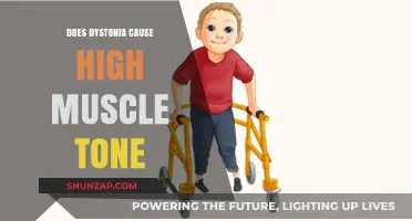 Dystonia and Muscle Tone: What's the Link?
