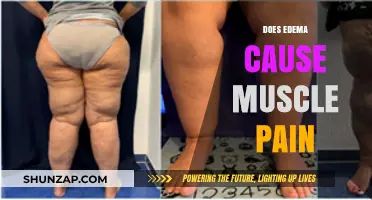 Edema and Muscle Pain: What's the Link?