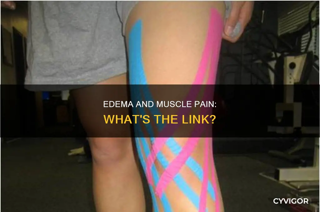 does edema cause muscle pain