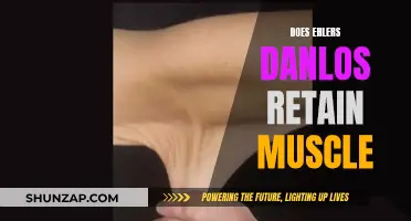 How Ehlers-Danlos Affects Muscle Development and Retention