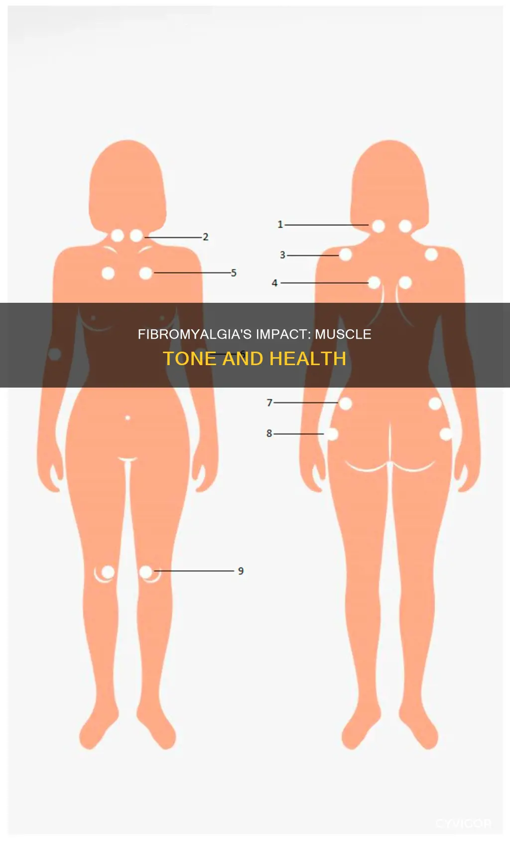does fibromalgia not tone muscles