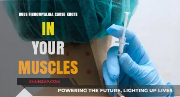 Fibromyalgia: Understanding Muscle Knots and Their Causes