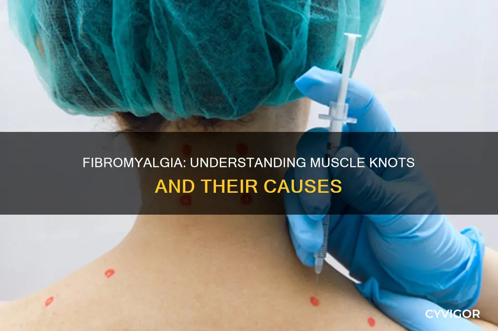 does fibromyalgia cause knots in your muscles