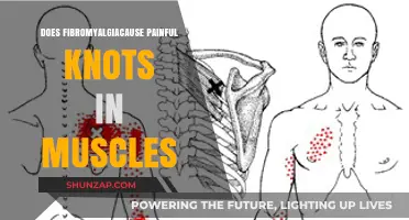 Fibromyalgia and Muscle Knots: Unraveling the Painful Connection