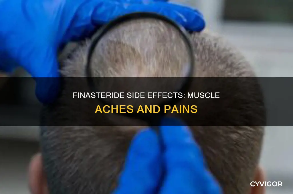 does finasteride cause muscle aches