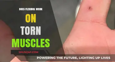 Does Flexirol Effectively Heal Torn Muscles? A Comprehensive Review