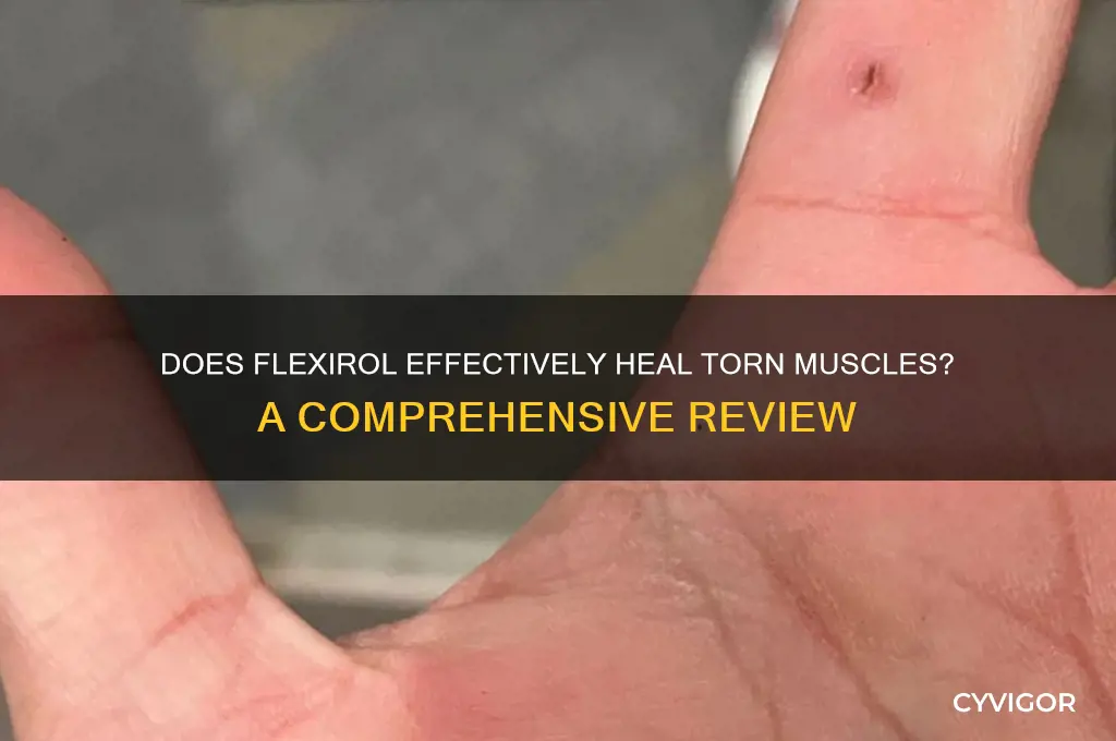 does flexirol work on torn muscles