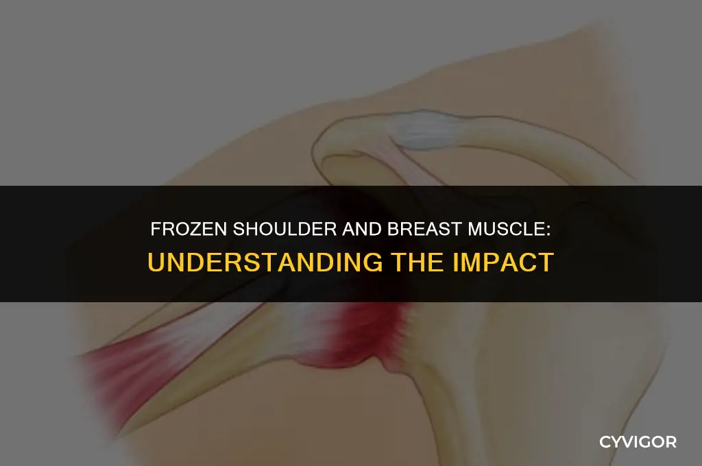 does frozen shoulder affect the muscle over your breast
