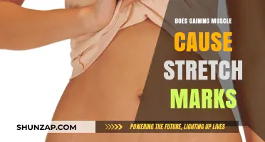 Building Muscle: Stretch Marks and How to Prevent Them