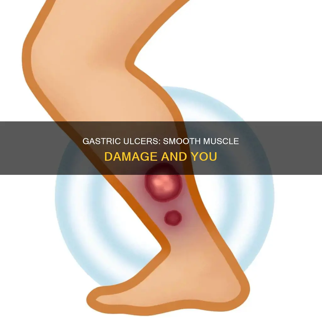 does gastric ulcer causes damage to smooth muscle