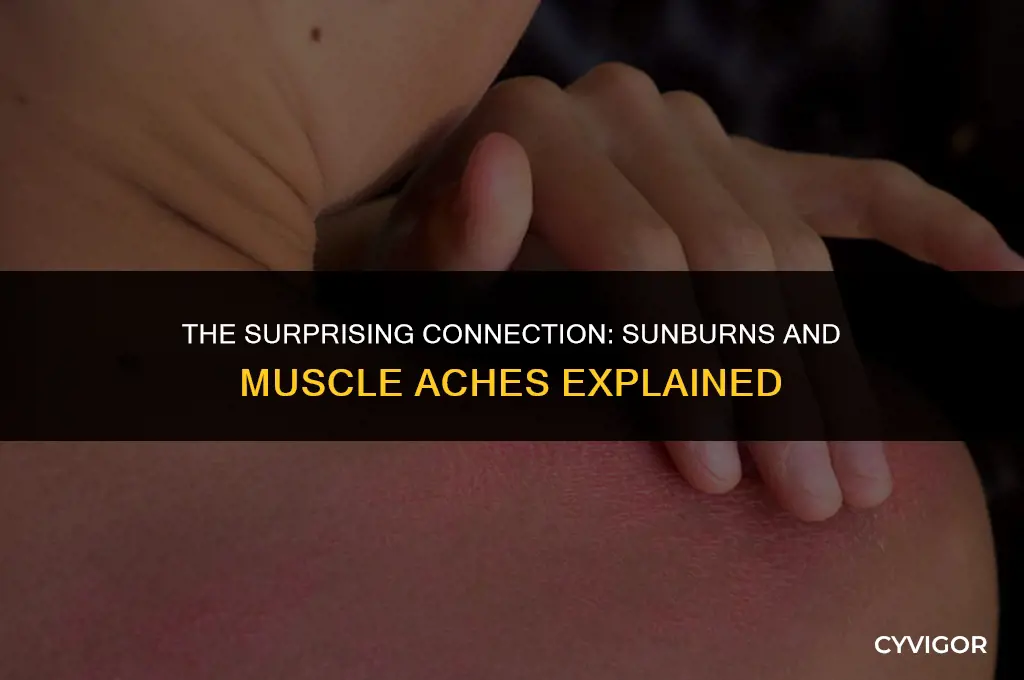 does getting a sunburn make your muscles ache