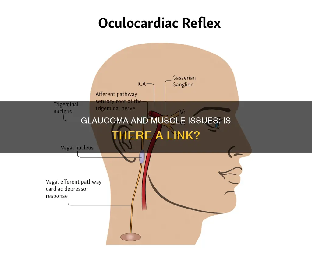 does glaucoma cause muscle issues