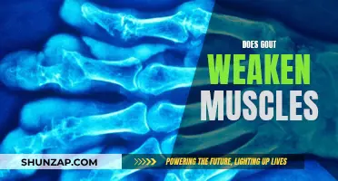 Gout's Impact: Muscle Weakness and Potential Complications