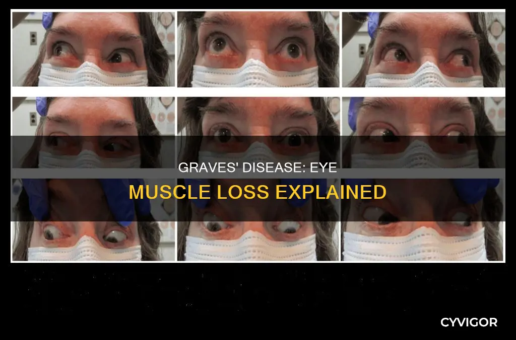 does graves disease cause muscle loss in eyes