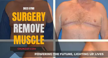 Gyno Surgery: Does It Affect Muscle?