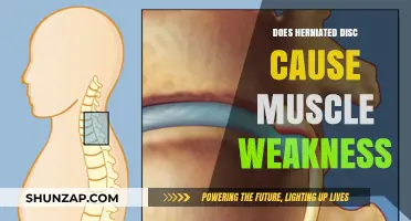Herniated Disc: Can It Cause Muscle Weakness?