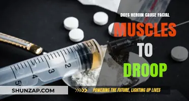 Heroin's Impact: Facial Muscle Droop Explained