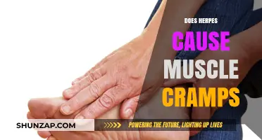 Herpes and Muscle Cramps: What's the Link?