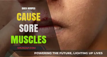 Herpes and Sore Muscles: Is There a Link?
