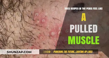 Herpes vs. Pulled Muscle: Understanding Penile Pain and Symptoms