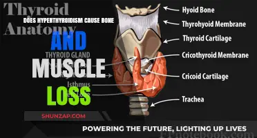 Hyperthyroidism: Bone and Muscle Loss Risk?