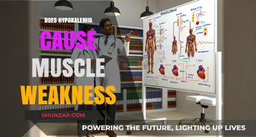 Hypokalemia: Understanding the Link to Muscle Weakness