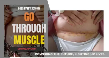 Hysterectomy: Cutting Through Muscle for Uterus Removal
