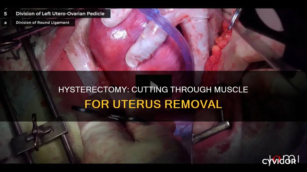 does hyseterctomy go through muscle