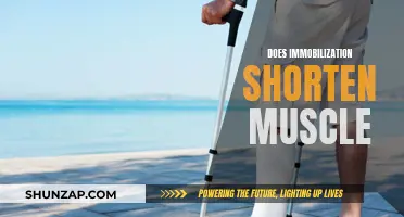 Immobilization: The Unseen Impact on Muscle Health