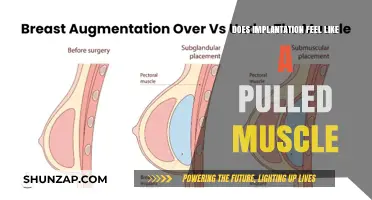 Implantation vs. Pulled Muscle: Understanding Early Pregnancy Sensations