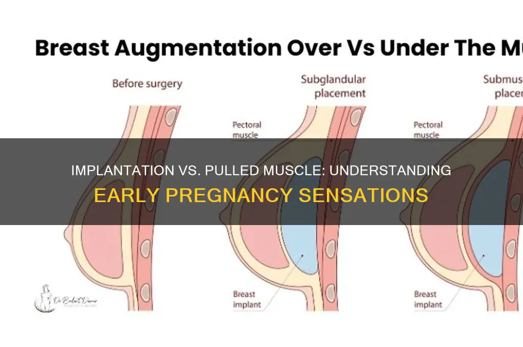 does implantation feel like a pulled muscle