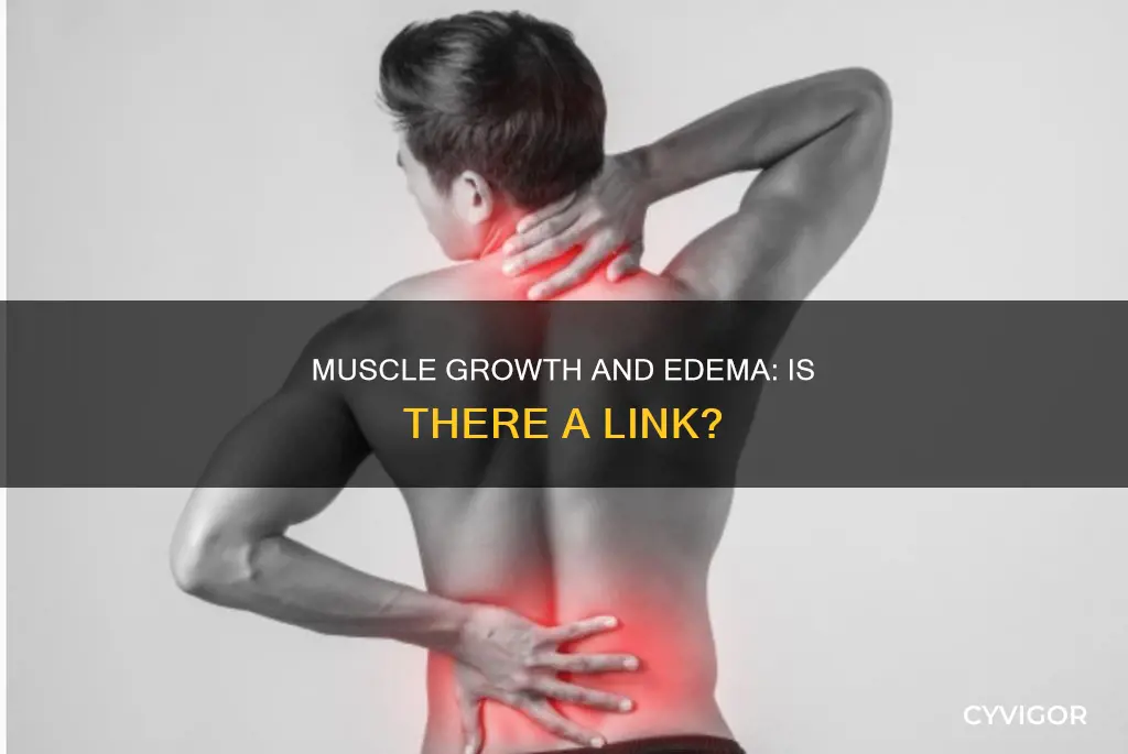 does increased muscle mass cause edema