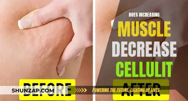 Building Muscle to Reduce Cellulite: Does it Work?